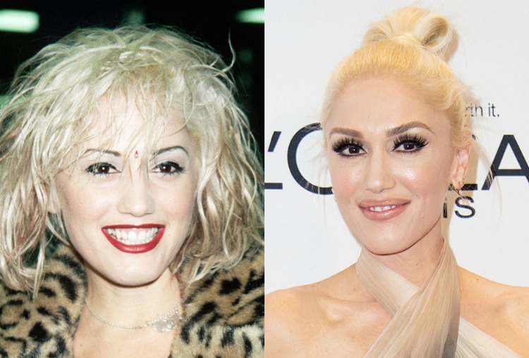 6celeb-transformations-before-after-03.jpg