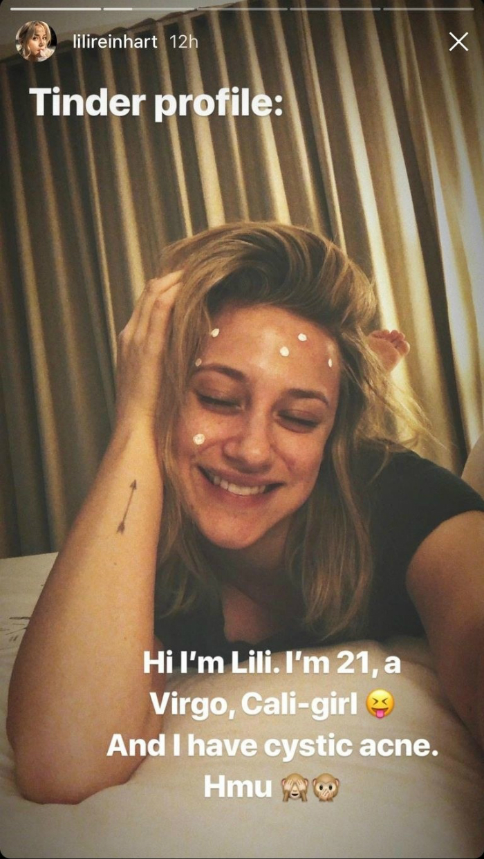 celebs_zits_01.jpg
