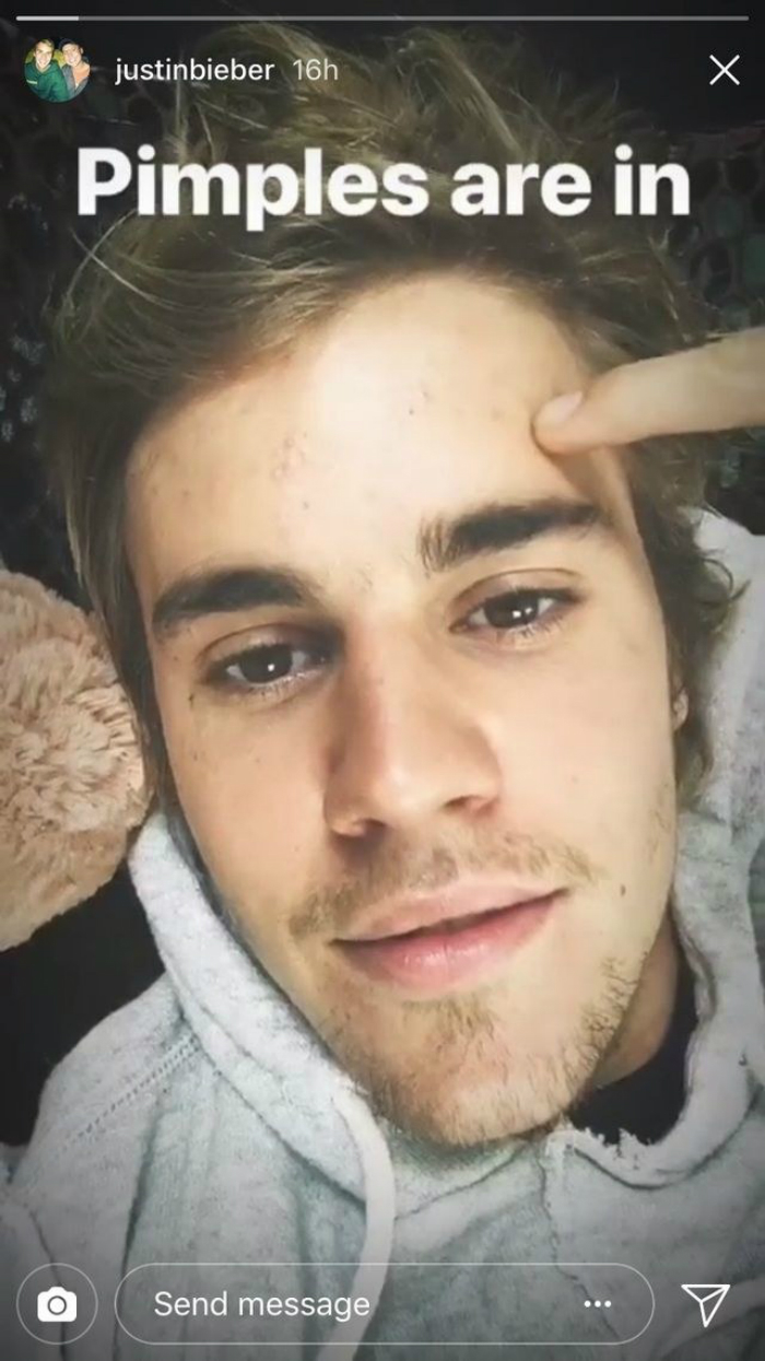 celebs_zits_02.jpg