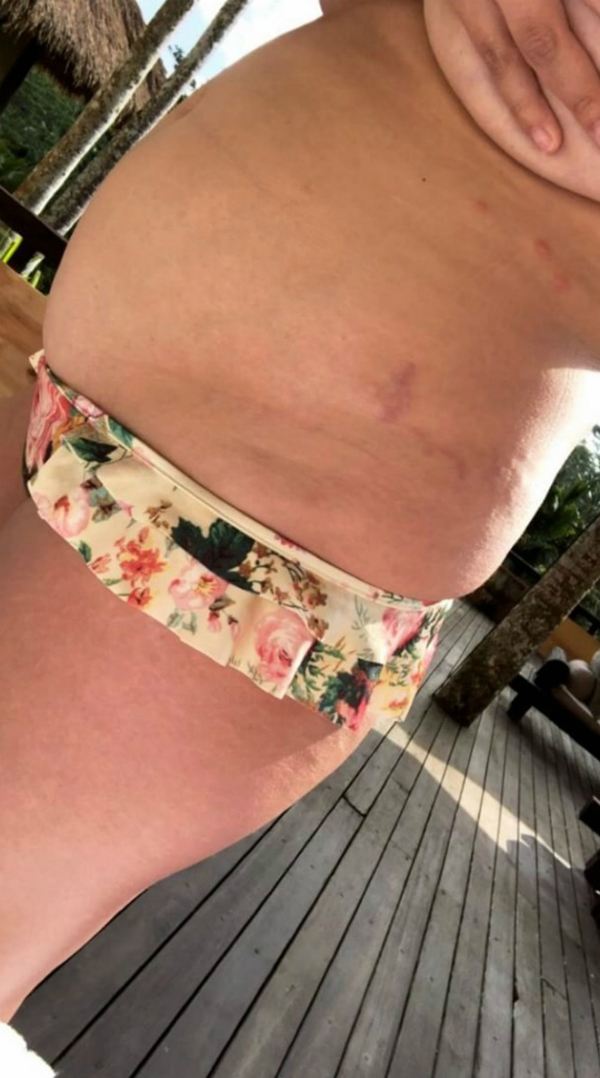 chrissystrethcmarks_01.jpg
