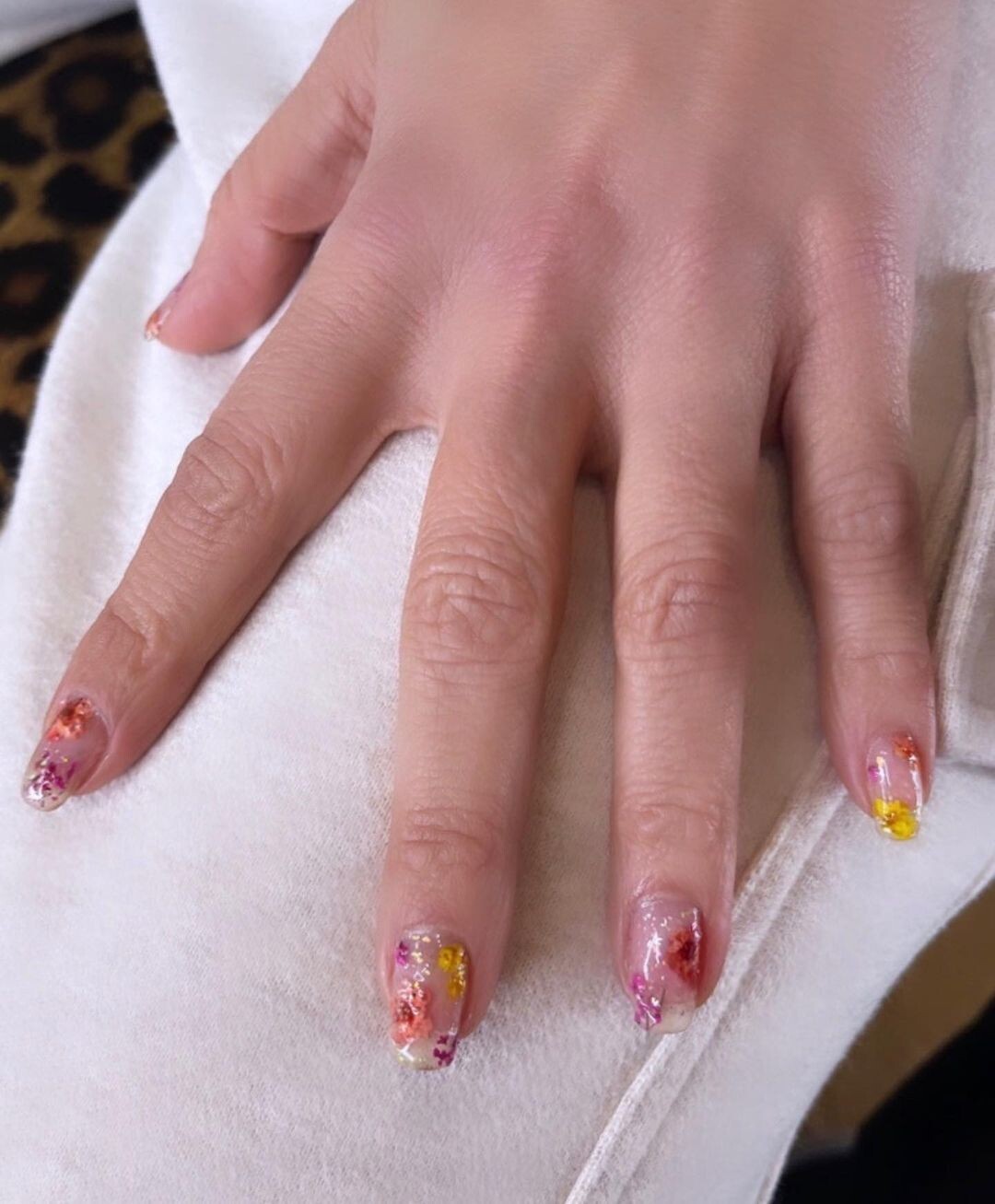 nailstombachikbnew
