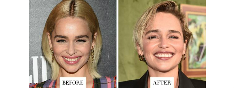 10celebtransformations_02.jpg